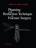 Plánovanie a redukčná technika pri operácii zlomenín - Planning and Reduction Technique in Fracture Surgery