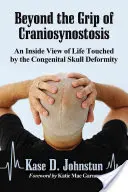 Za hranicami kraniosynostózy: Pohľad zvnútra na život postihnutý vrodenou deformáciou lebky - Beyond the Grip of Craniosynostosis: An Inside View of Life Touched by the Congenital Skull Deformity