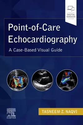 Echokardiografia v mieste starostlivosti: Vizuálna príručka na klinických prípadoch - Point-Of-Care Echocardiography: A Clinical Case-Based Visual Guide