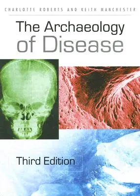 Archeológia chorôb - The Archaeology of Disease
