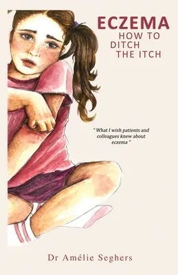 Ekzém: Ako sa zbaviť svrbenia - Eczema: How to Ditch the Itch