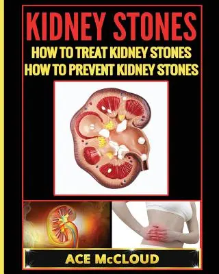 Obličkové kamene: Ako liečiť obličkové kamene: Ako predchádzať obličkovým kameňom: Ako predchádzať obličkovým kameňom? - Kidney Stones: How To Treat Kidney Stones: How To Prevent Kidney Stones