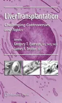Transplantácia pečene: Náročné kontroverzie a témy - Liver Transplantation: Challenging Controversies and Topics