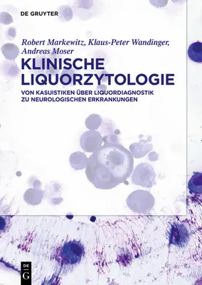 Klinická alkohológia - Klinische Liquorzytologie