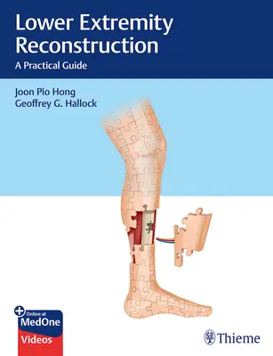 Rekonštrukcia dolných končatín: Praktická príručka - Lower Extremity Reconstruction: A Practical Guide