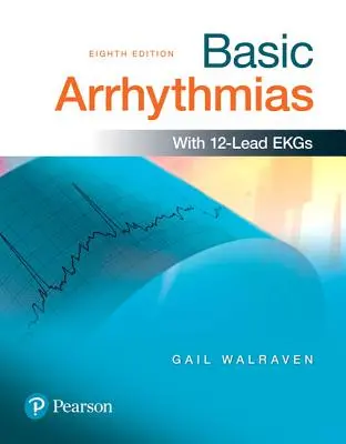 Základné arytmie - Basic Arrhythmias