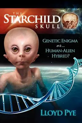 Lebka Starchilda - genetická záhada alebo hybrid človeka a mimozemšťana? - The Starchild Skull -- Genetic Enigma or Human-Alien Hybrid?