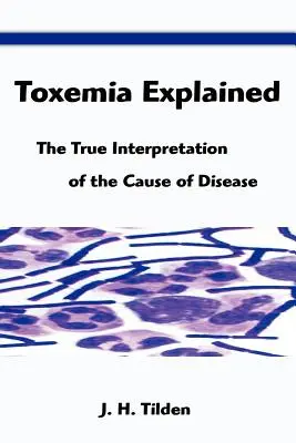 Vysvetlenie toxémie: Tilden: Vysvetlenie príčiny choroby: pravdivý výklad príčiny choroby - Toxemia Explained: The True Interpretation of the Cause of Disease