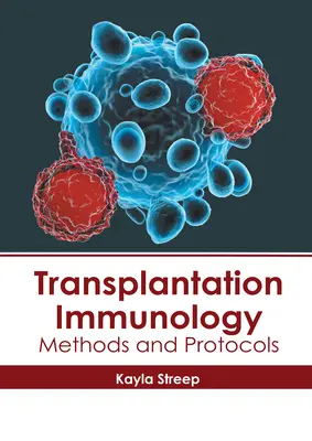 Transplantačná imunológia: Metódy a protokoly - Transplantation Immunology: Methods and Protocols