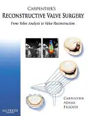 Carpentierova rekonštrukčná chirurgia chlopní: Od analýzy chlopní k ich rekonštrukcii - Carpentier's Reconstructive Valve Surgery: From Valve Analysis to Valve Reconstruction