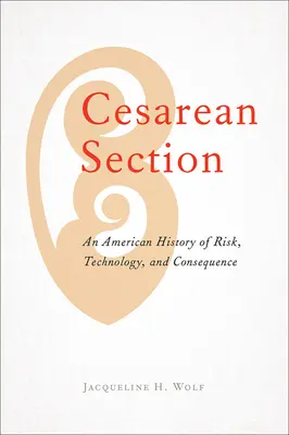 Cisársky rez: Cisársky rez: americké dejiny rizika, technológie a dôsledkov - Cesarean Section: An American History of Risk, Technology, and Consequence