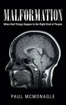 Malformácie: Keď sa zlé veci stávajú správnym ľuďom - Malformation: When Bad Things Happen to the Right Kind of People