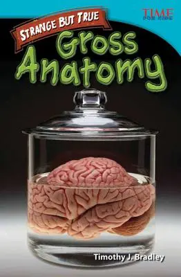 Zvláštne, ale pravdivé: Hrubá anatómia - Strange but True: Gross Anatomy