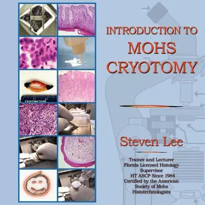 Úvod do kryotómie MOHS - Introduction to MOHS Cryotomy