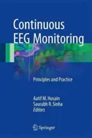 Kontinuálne monitorovanie EEG: Princípy a prax - Continuous Eeg Monitoring: Principles and Practice