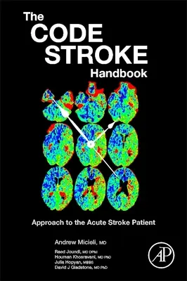 Príručka o údere kódu: Prístup k pacientovi s akútnou mozgovou príhodou - The Code Stroke Handbook: Approach to the Acute Stroke Patient
