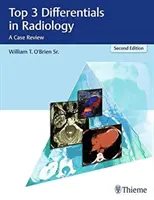 Top 3 diferenciály v rádiológii: Prehľad prípadov - Top 3 Differentials in Radiology: A Case Review