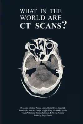Čo je to preboha CT vyšetrenie? - What in the World are CT Scans?