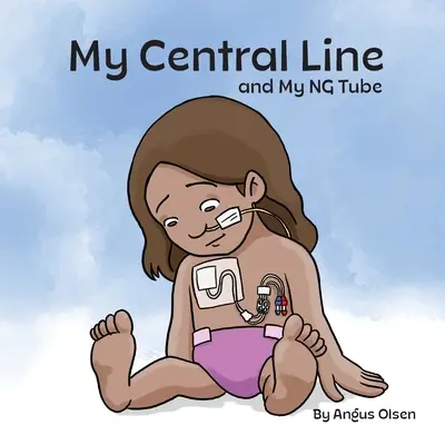 Moja centrálna linka a moja NG hadička - My Central Line and My NG Tube