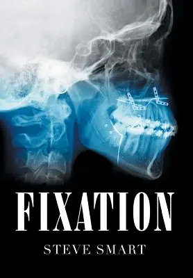 Fixácia - Fixation