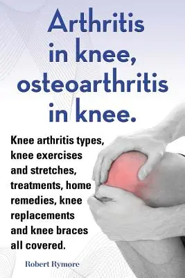 Artritída v kolene, osteoartróza v kolene. Typy artritídy v kolene, cvičenia a strečingy v kolene, liečba, domáce prostriedky, náhrady kolena a b - Arthritis in knee, osteoarthritis in knee. Knee arthritis types, knee exercises and stretches, treatments, home remedies, knee replacements and knee b