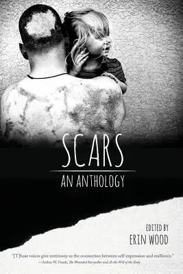 Jazvy: Antológia - Scars: An Anthology