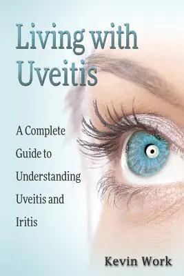 Život s uveitídou: Kompletný sprievodca uveitídou a iritídou - Living with Uveitis: A Complete Guide to Uveitis and Iritis