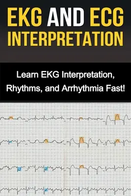 Interpretácia EKG a EKG: Naučte sa rýchlo interpretovať EKG, rytmy a arytmie! - EKG and ECG Interpretation: Learn EKG Interpretation, Rhythms, and Arrhythmia Fast!