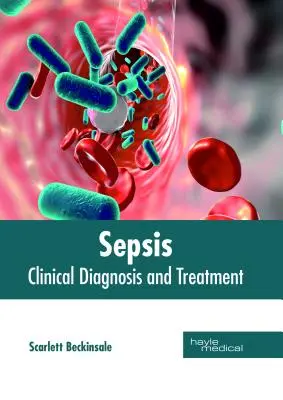 Sepsa: Klinická diagnostika a liečba - Sepsis: Clinical Diagnosis and Treatment
