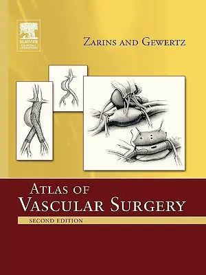 Atlas cievnej chirurgie - brožované vydanie - Atlas of Vascular Surgery - Paperback Edition
