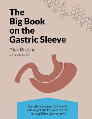 Veľká kniha o žalúdočnom rukáve: Všetko, čo potrebujete vedieť, aby ste schudli a dobre žili s vertikálnou rukávovou gastrektómiou - The Big Book on the Gastric Sleeve: Everything You Need to Know to Lose Weight and Live Well with the Vertical Sleeve Gastrectomy