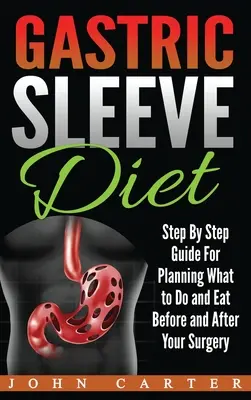 Diéta so žalúdočným rukávom: Vydanie (1): Sprievodca krok za krokom pre plánovanie toho, čo robiť a jesť pred a po operácii - Gastric Sleeve Diet: Step By Step Guide For Planning What to Do and Eat Before and After Your Surgery