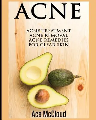 Akné: Liečba akné: Odstránenie akné: Odstraňovanie akné: Prostriedky na odstránenie akné pre čistú pleť - Acne: Acne Treatment: Acne Removal: Acne Remedies For Clear Skin