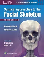 Chirurgické prístupy k tvárovej kostre - Surgical Approaches to the Facial Skeleton
