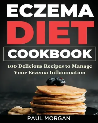 Ekzémová kuchárka DIet: 100 chutných receptov na zvládnutie zápalu ekzému - Eczema DIet Cookbook: 100 Delicious Recipes to Manage your Eczema Inflammation