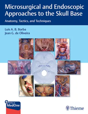 Mikrochirurgické a endoskopické prístupy k báze lebky: Anatómia, taktika a techniky - Microsurgical and Endoscopic Approaches to the Skull Base: Anatomy, Tactics, and Techniques