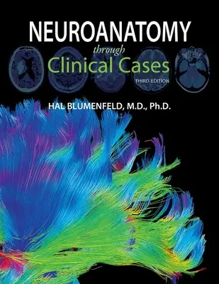 Neuroanatómia prostredníctvom klinických prípadov - Neuroanatomy Through Clinical Cases