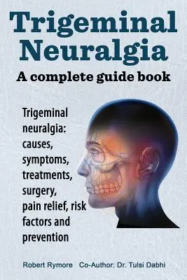 Trigeminálna neuralgia: kompletná príručka. Trigeminálna neuralgia: príčiny, príznaky, liečba, chirurgický zákrok, - Trigeminal neuralgia: a complete guide book. Trigeminal neuralgia: causes, symptoms, treatments, surgery,