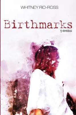 Materské znamienka - Birthmarks