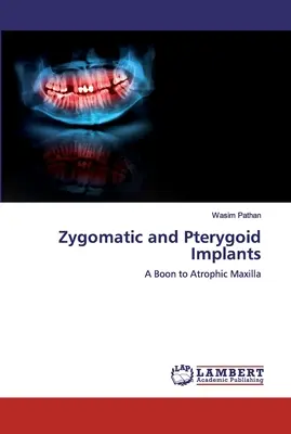 Zygomatické a pterygoidné implantáty - Zygomatic and Pterygoid Implants