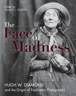 Tvár šialenstva: Diamond a vznik psychiatrickej fotografie - Face of Madness: Hugh W. Diamond and the Origin of Psychiatric Photography