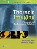 Zobrazovanie hrudníka: Pľúcna a kardiovaskulárna rádiológia - Thoracic Imaging: Pulmonary and Cardiovascular Radiology