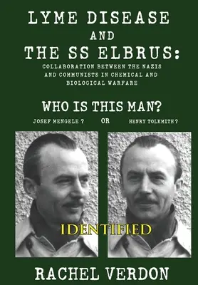 Lymská borelióza a SS Elbrus - Lyme Disease and the SS Elbrus