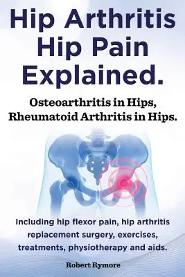 Vysvetlenie artritídy bedrového kĺbu, bolesti bedrového kĺbu. Osteoartróza bedrových kĺbov, reumatoidná artritída bedrových kĺbov. Vrátane operácie artrózy bedrového kĺbu, bolesti bedrového kĺbu, cvičenia, - Hip Arthritis, Hip Pain Explained. Osteoarthritis in Hips, Rheumatoid Arthritis in Hips. Including Hip Arthritis Surgery, Hip Flexor Pain, Exercises,