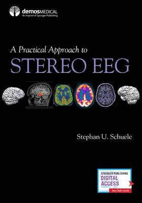 Praktický prístup k stereoskopickému EEG - A Practical Approach to Stereo Eeg
