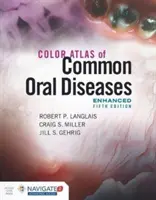 Farebný atlas bežných ochorení ústnej dutiny, rozšírené vydanie - Color Atlas of Common Oral Diseases, Enhanced Edition
