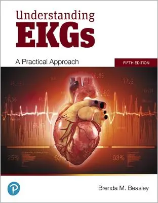 Pochopenie EKG: praktický prístup - Understanding EKGs: A Practical Approach