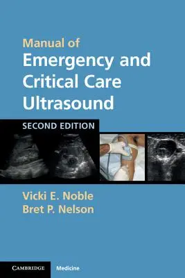 Príručka ultrazvuku pre urgentnú a kritickú starostlivosť - Manual of Emergency and Critical Care Ultrasound