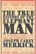 Pravdivá história Slonieho muža - True History of the Elephant Man