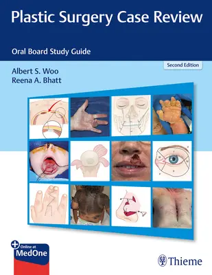 Prehľad prípadov plastickej chirurgie: Študijná príručka pre ústnu komisiu - Plastic Surgery Case Review: Oral Board Study Guide